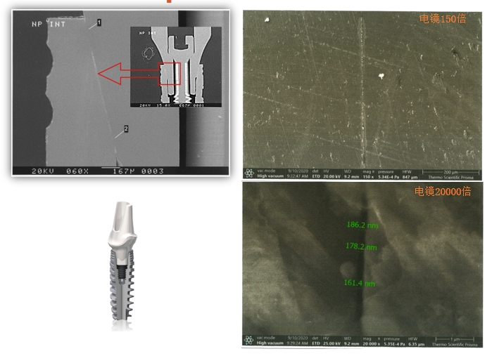 Gap between implant and abutment