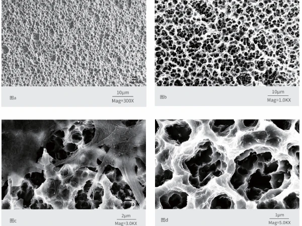 SLA (Sandblasted, Large-grit, Acid-etched) treatment of implants