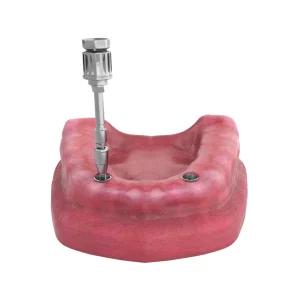 Locator Abutment Application