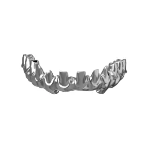 Titanium Bar Implant Bridge