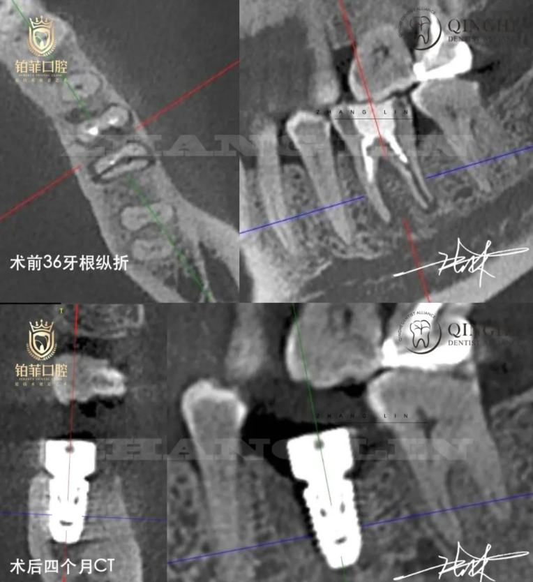 X-ray Comparison